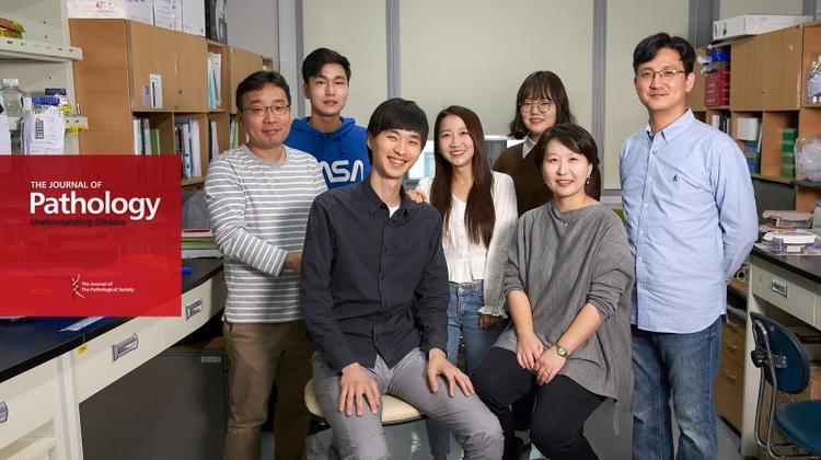 New Therapeutic Avenue in the Fight Against Chronic Liver Disease